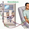 Introduction in Dialysis Treatment