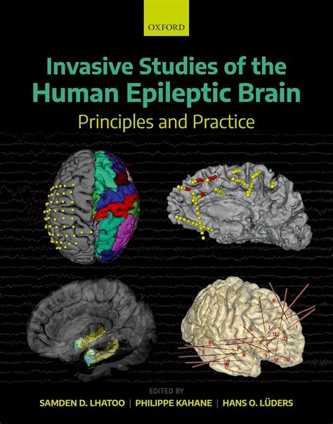 Invasive Studies Of The Human Epileptic Brain: Principles And Practice