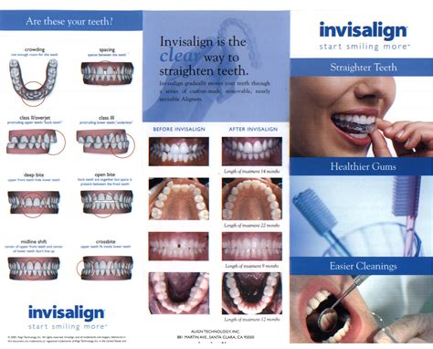 Invisalign Pictures Template