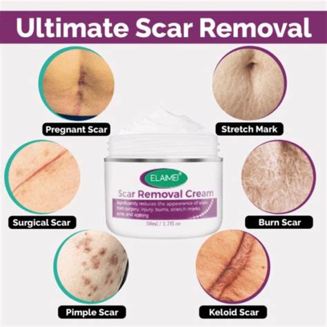 Invisiscar Skin Renewal Cream: Unveiling Flawless and Glowing Skin