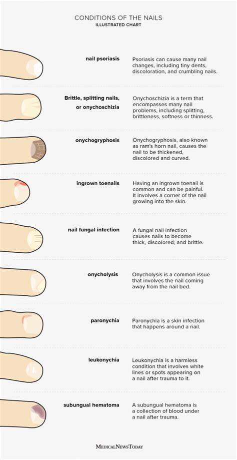 Iron Deficiency Nail Health Chart