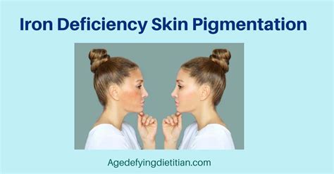 Uncover the Dark Truth: The Emotional Impact of Iron Deficiency on Your Skin Pigmentation