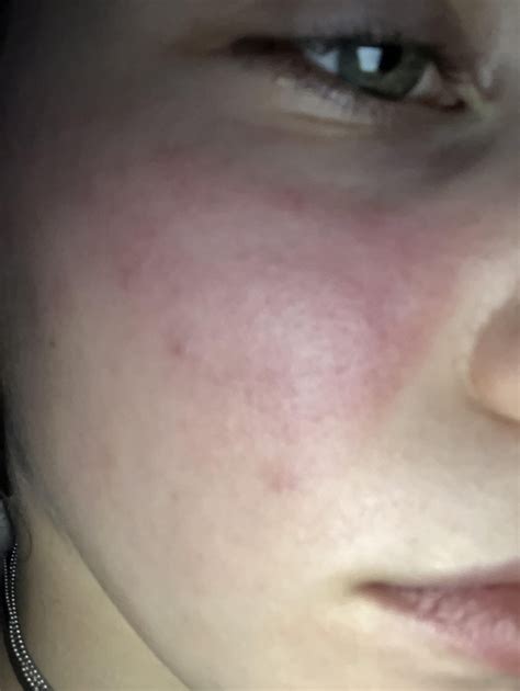 Cumulative Concerns: Unpacking the Myths Behind the Effects of Ejaculation on Your Skin