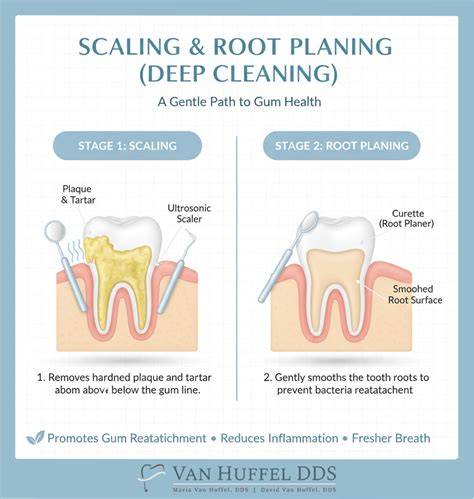 Is Scaling And Root Planing Painful