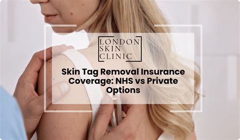 Saying Goodbye to Skin Tags: Your Insurance Might Have You Covered!