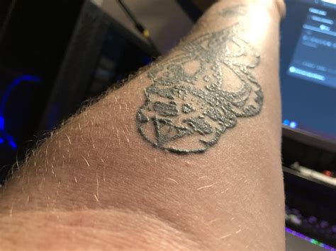 Little Itchy Bumps On Tattoo