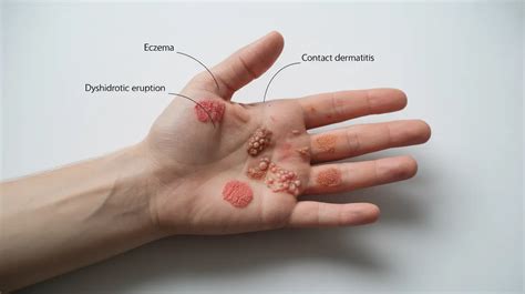 Itchy Left Hand: Causes & Fast Relief