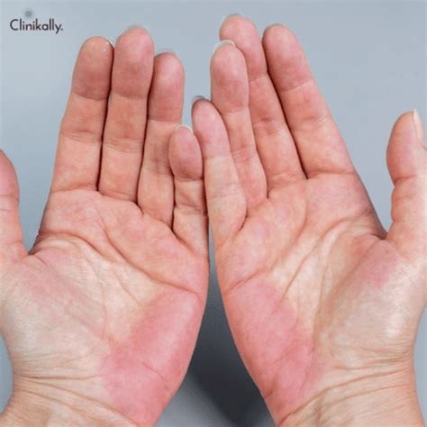 Itchy Right Hand: Causes & Fast Relief