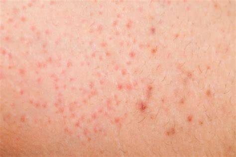 The Agony of Post-Shave Itch: How to Soothe Irritated Skin