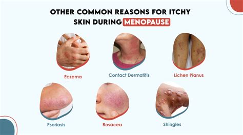 Relief for Itchy Skin During Menopause: Tips and Remedies