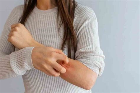 Scratch vs. Skin: Unraveling the Mysteries of Itchy Skin Bruising