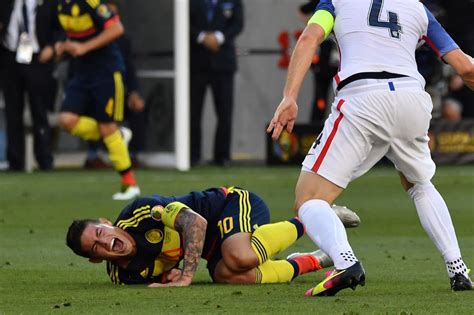 James Rodriguez Injury Timeline