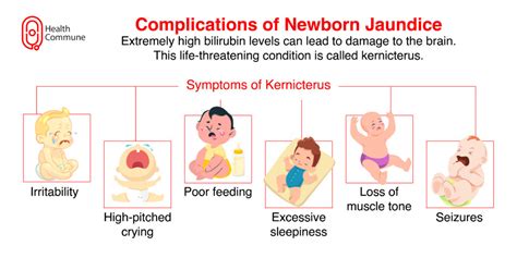 Yellow Alert: Jaundice in Babies - When to Seek Medical Attention