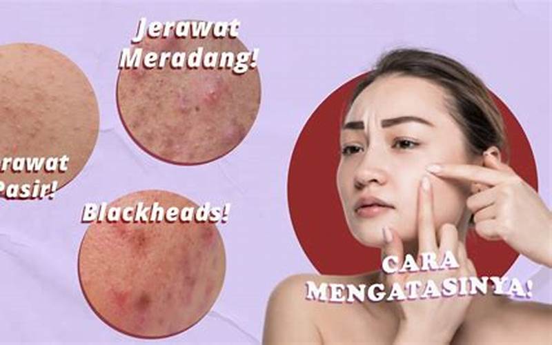 Jerawat Kecil Putih: Sebab, Penyebab Dan Cara Mengatasinya