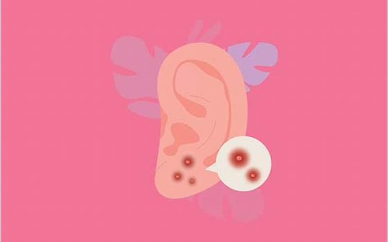 Jerawat Pada Telinga: Apa Penyebabnya Dan Bagaimana Cara Mengatasinya?