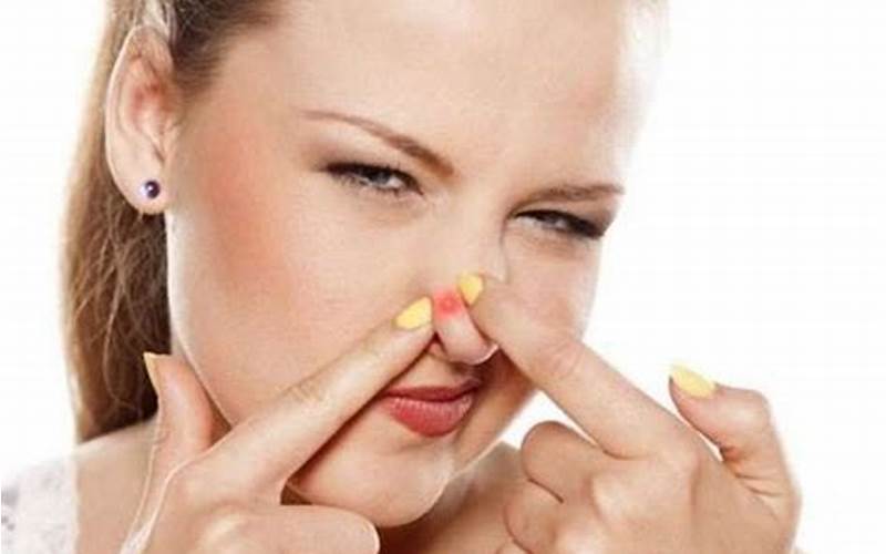 Jerawat Samping Hidung: Apa Yang Menyebabkannya Dan Bagaimana Menghilangkannya?
