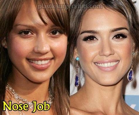 Jessica Alba Nose
