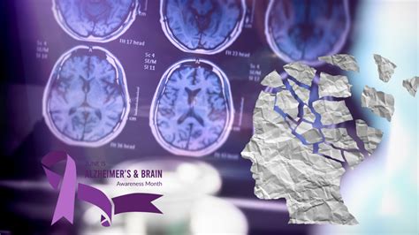 Unveiling the Importance of June - A Celebration of National Awareness Month