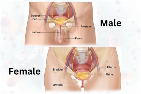 Key Differences Between Male Prostate Cancer and Female Urethral Cancer