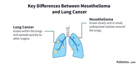 Key Differences Mesothelioma Vs Lung Cancer Difference