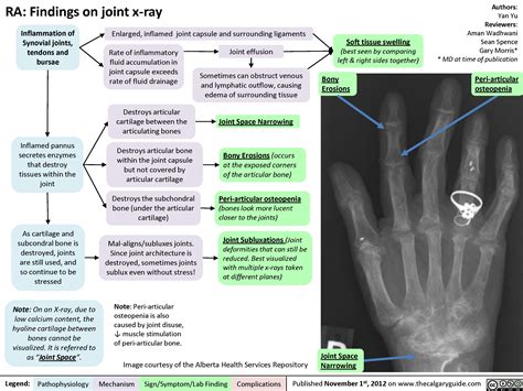 Key Radiographic Features to Look For