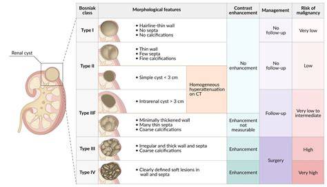 Kidney Cyst Size Chart
