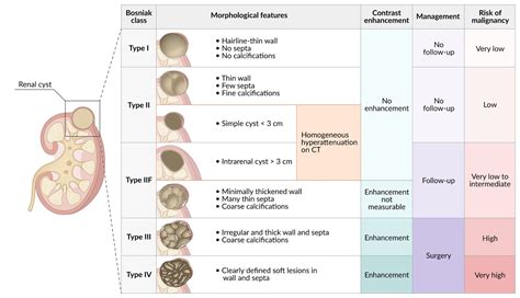 Kidney Cyst Size Chart In Mm