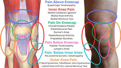 Knee Pain & Injuries: Causes, Relief, Recovery.