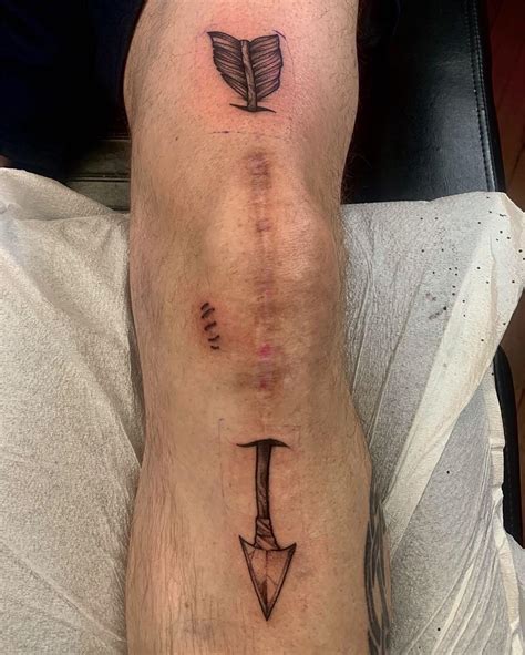 Knee Scar Tattoo