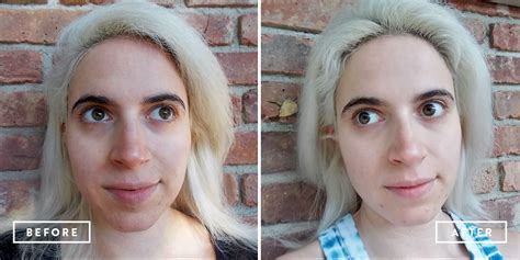 Discover The Miraculous Effects Of Kombucha On Your Skin