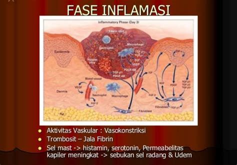 Kondisi Inflamasi