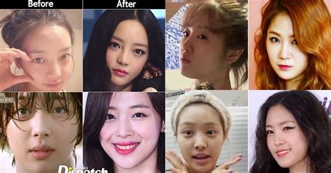 Kpop Before And After