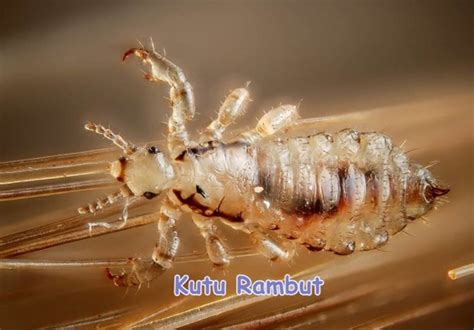 Kutu Rambut