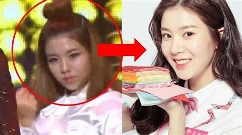 Kwon Eunbi Plastic Surgery