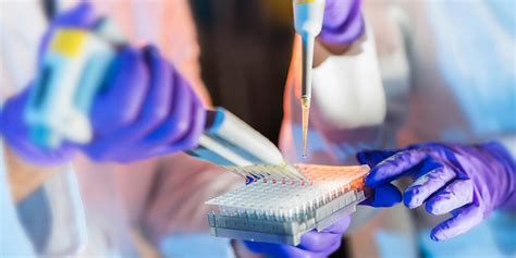 LabCorp Therapeutic Drug Monitoring