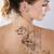 Laser Tattoo Removal Beverly Hills