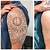 Laser Tattoo Removal Effectiveness