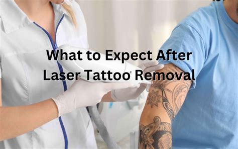 Laser Tattoo Removal Kansas City QSwitched Laser Lee's