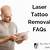 Laser Tattoo Removal Parramatta