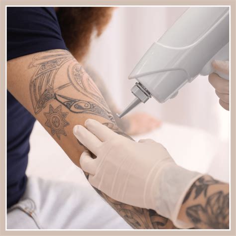 Laser Hair Removal Tattoo