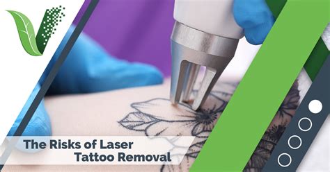 Dangers Of Laser Tattoo Removal Everything You Should
