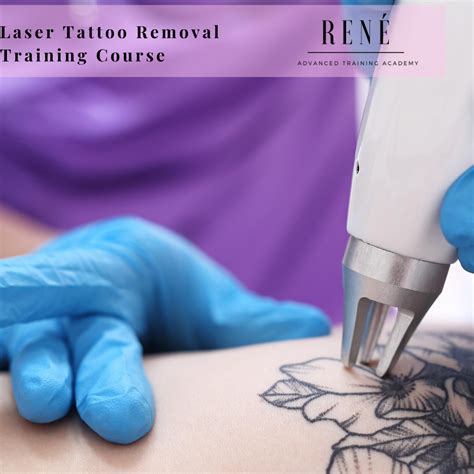 What Qualifications Do You Need To Be A Laser Tattoo