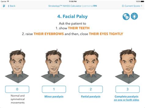 Laughter as Medicine in NIHSS Facial Palsy Edition