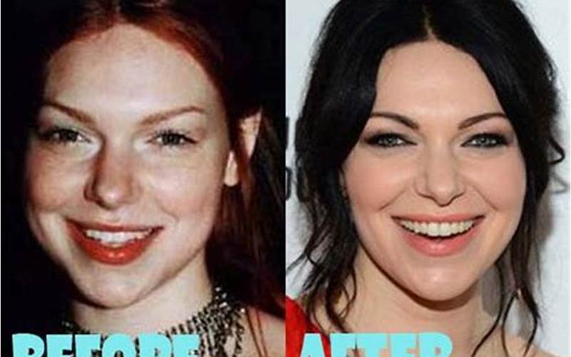 Laura Prepon Face Lift: What You Need to Know