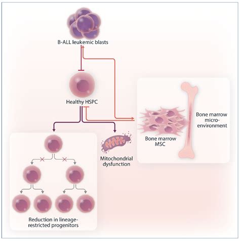 Leukemia: The Bone Marrow Challenge
