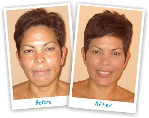 Unlock the Secret to Radiant Skin with Life Cell's Nourishing Shampoo: A Comprehensive Review