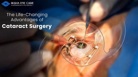 Life-Changing Cataract Surgery