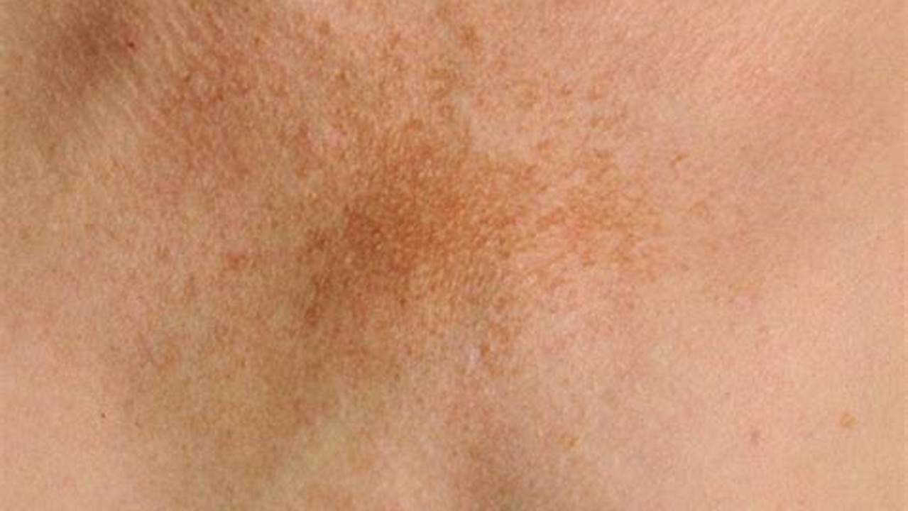 Baby Skin Issues and Conditions What to Expect