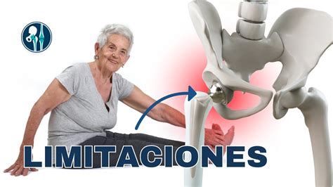 Prótesis de cadera antes de cumplir los 40: los motivos de la nueva