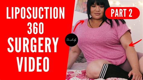 360 Surgery
